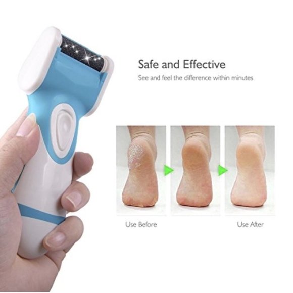 JuiceBlendDry® Electric Foot Callus Remover & Shaver Pedi  (+ Extra Roller) - Picture 3 of 7